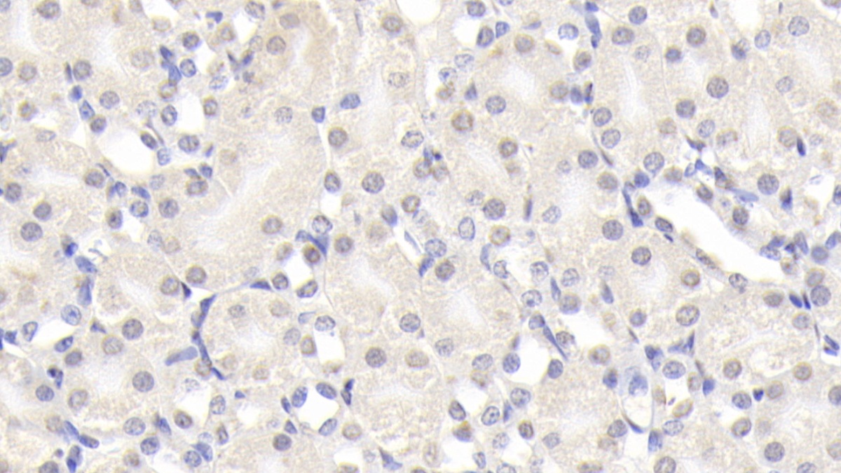 Polyclonal Antibody to Immunoglobulin G3 (IgG3)