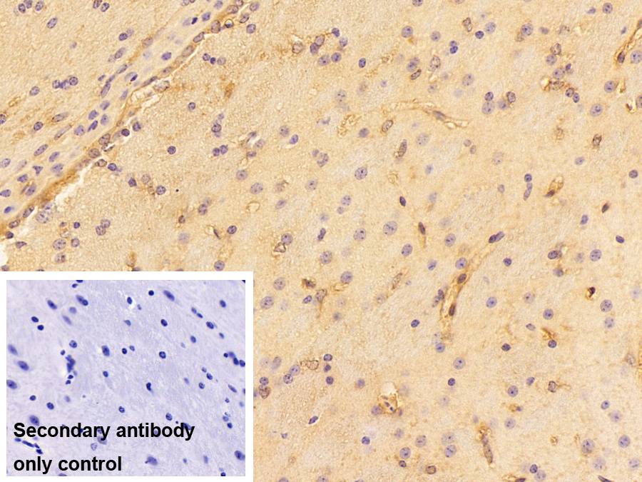 Polyclonal Antibody to Thrombin/Antithrombin Complex (TAT)