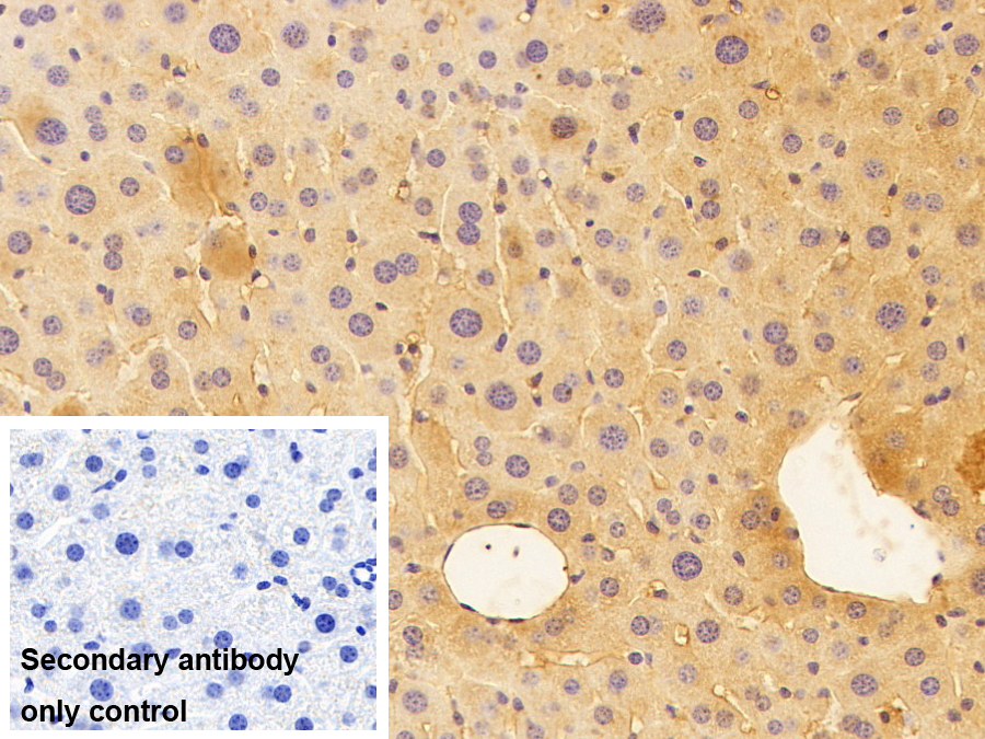Polyclonal Antibody to Thrombin/Antithrombin Complex (TAT)