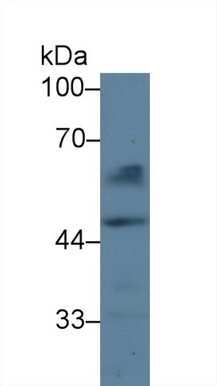 Polyclonal Antibody to Coagulation Factor X (F10)