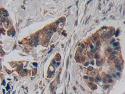 Polyclonal Antibody to Corticotropin Releasing Factor (CRF)