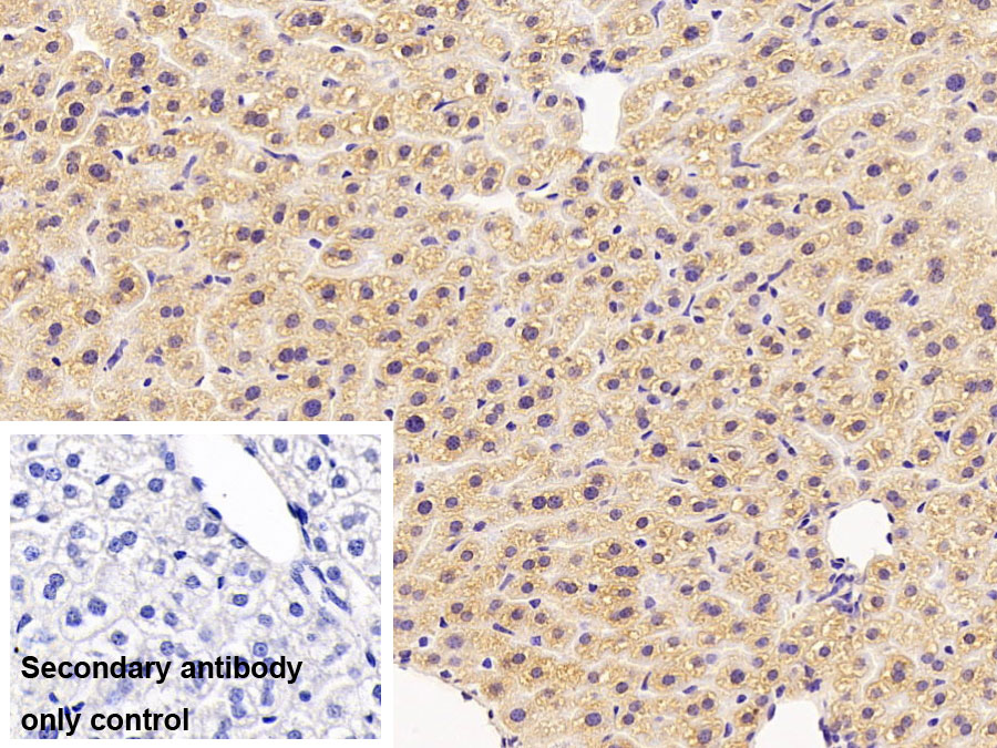 Polyclonal Antibody to Nitric Oxide Synthase 2, Inducible (NOS2)