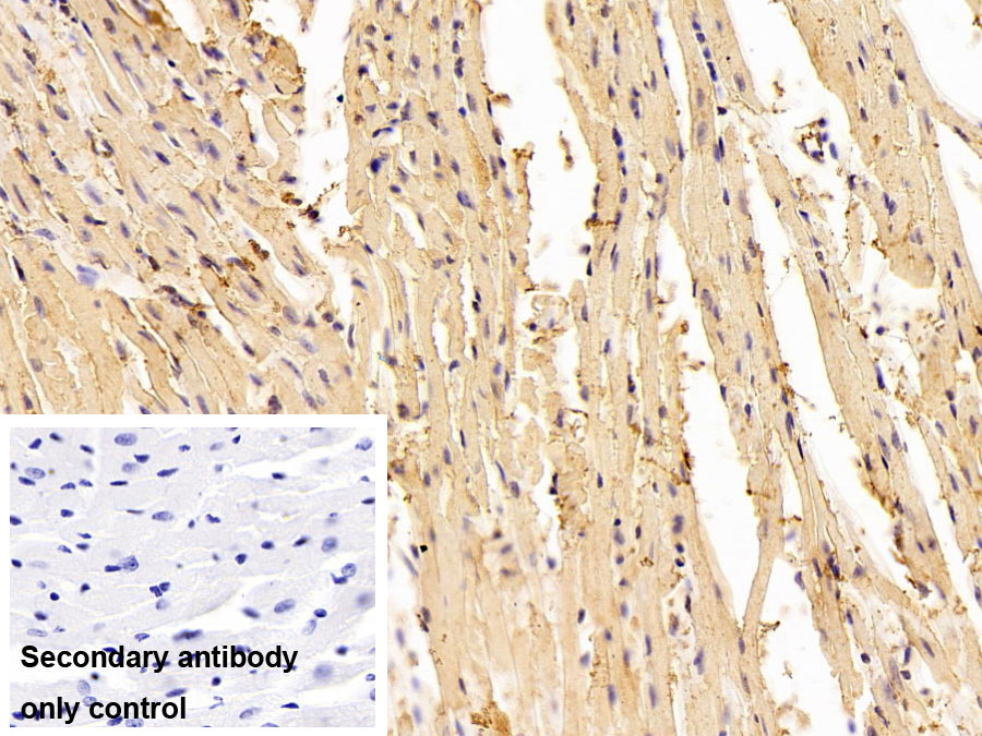 Polyclonal Antibody to Nitric Oxide Synthase 2, Inducible (NOS2)