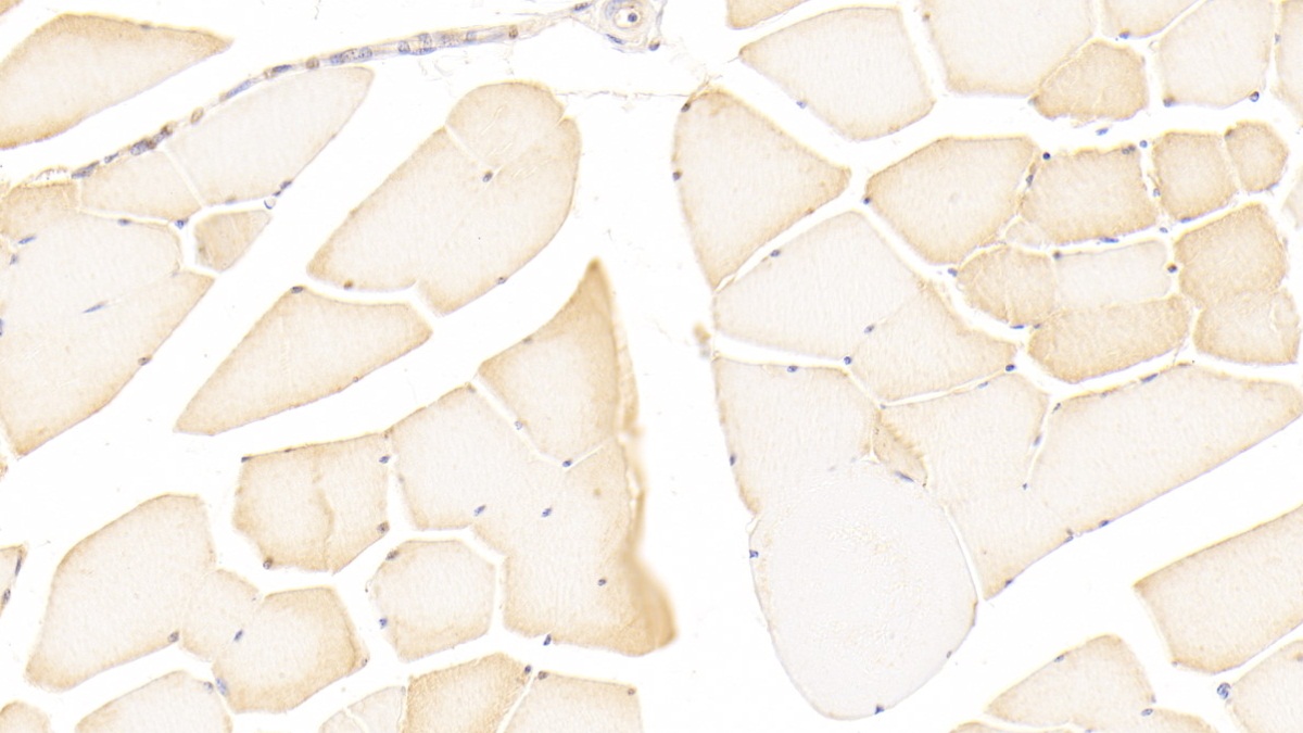 Polyclonal Antibody to Nitric Oxide Synthase 2, Inducible (NOS2)