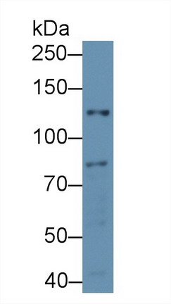 Polyclonal Antibody to Nitric Oxide Synthase 2, Inducible (NOS2)