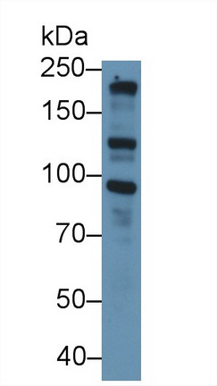 Polyclonal Antibody to Nitric Oxide Synthase 2, Inducible (NOS2)