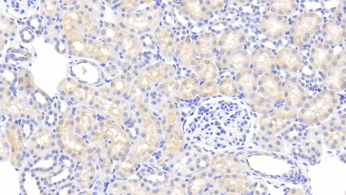 Polyclonal Antibody to Nitric Oxide Synthase 2, Inducible (NOS2)