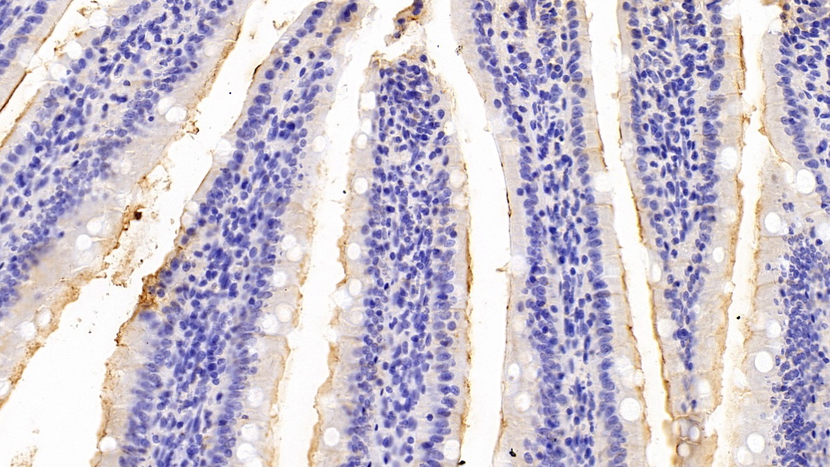 Polyclonal Antibody to Nitric Oxide Synthase 2, Inducible (NOS2)