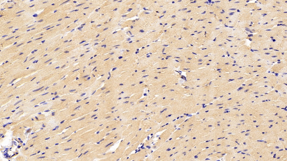 Polyclonal Antibody to Nitric Oxide Synthase 2, Inducible (NOS2)