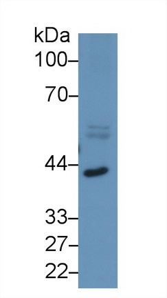 Polyclonal Antibody to Inhibin Beta A (INHbA)