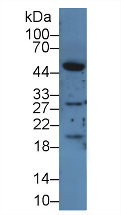 Polyclonal Antibody to Inhibin Beta A (INHbA)