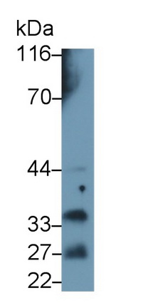 Polyclonal Antibody to Prolactin (PRL)