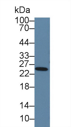 Polyclonal Antibody to Prolactin (PRL)