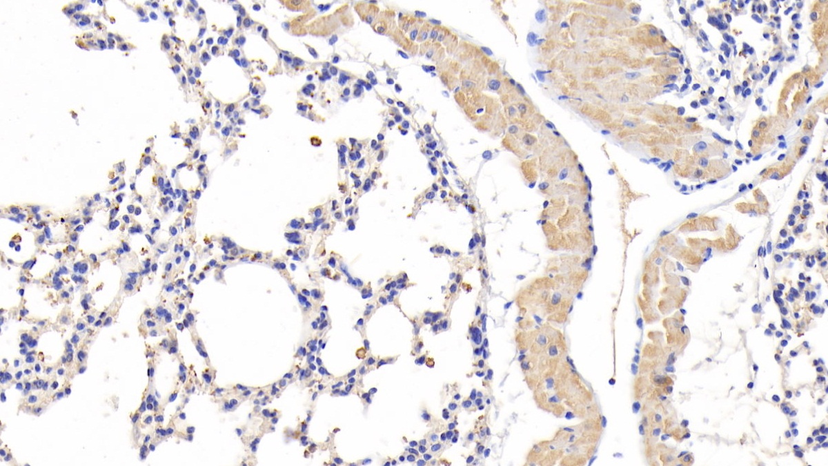 Polyclonal Antibody to Resistin (RETN)