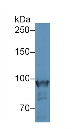 Polyclonal Antibody to Glycogen Phosphorylase, Muscle (PYGM)