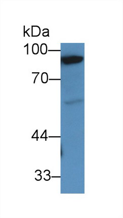 Polyclonal Antibody to Glycogen Phosphorylase, Muscle (PYGM)