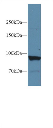 Polyclonal Antibody to Glycogen Phosphorylase, Liver (PYGL)