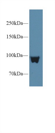 Polyclonal Antibody to Glycogen Phosphorylase, Liver (PYGL)