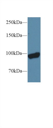 Polyclonal Antibody to Glycogen Phosphorylase, Liver (PYGL)