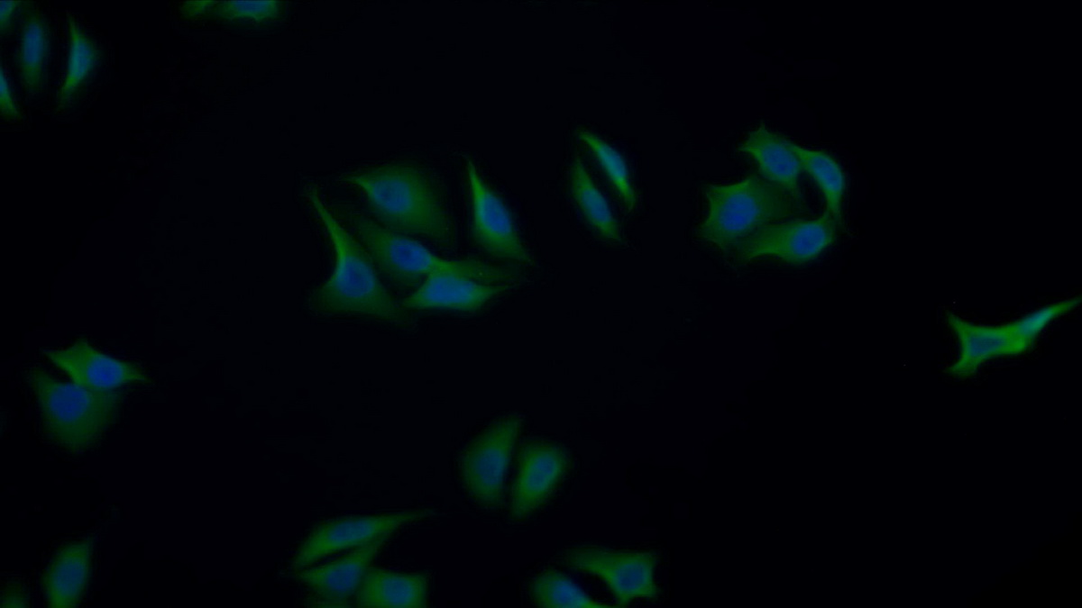 Polyclonal Antibody to Glycogen Phosphorylase, Liver (PYGL)