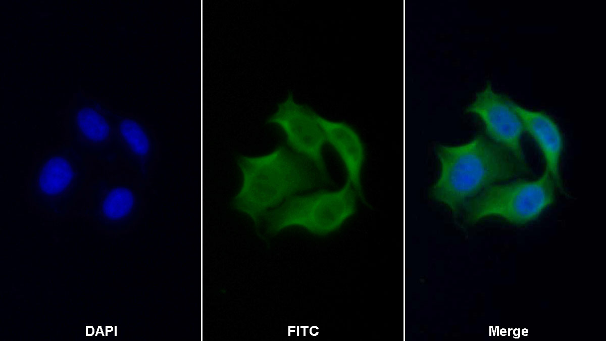 Polyclonal Antibody to Glycogen Phosphorylase, Liver (PYGL)