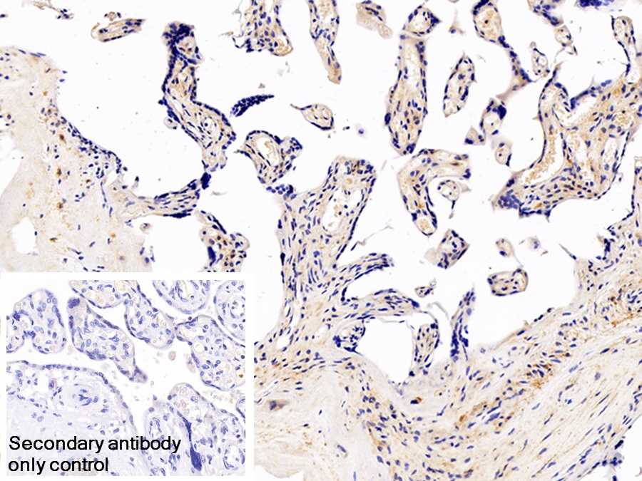 Polyclonal Antibody to Glycogen Phosphorylase, Liver (PYGL)