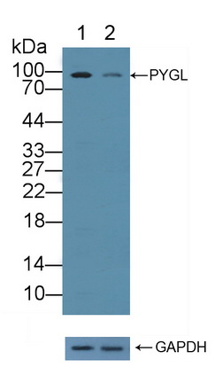 Polyclonal Antibody to Glycogen Phosphorylase, Liver (PYGL)