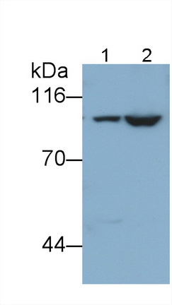 Polyclonal Antibody to Glycogen Phosphorylase, Liver (PYGL)