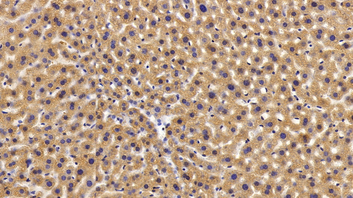 Polyclonal Antibody to Glycogen Phosphorylase, Liver (PYGL)