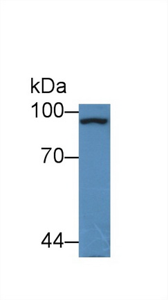 Polyclonal Antibody to Glycogen Phosphorylase, Liver (PYGL)