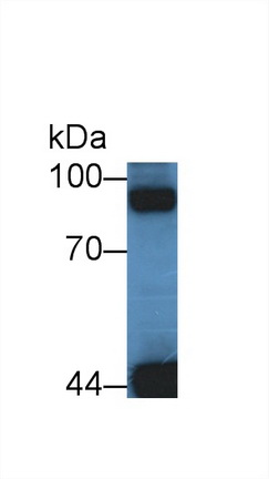 Polyclonal Antibody to Glycogen Phosphorylase, Liver (PYGL)