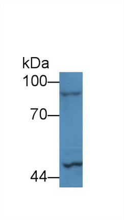 Polyclonal Antibody to Glycogen Phosphorylase, Liver (PYGL)