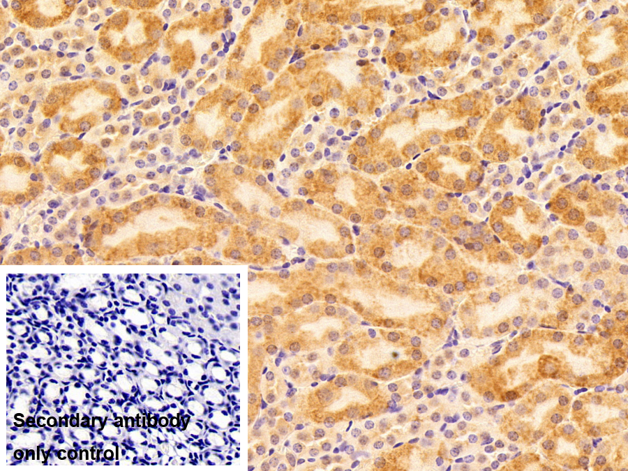 Polyclonal Antibody to Protease Activated Receptor 2 (PAR2)