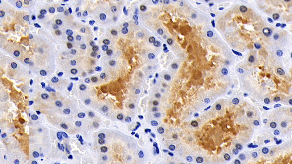 Polyclonal Antibody to Caspase 8 (CASP8)