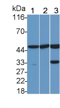 Polyclonal Antibody to Caspase 8 (CASP8)