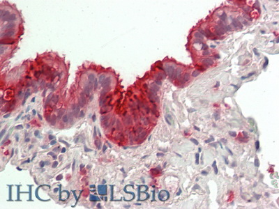 Polyclonal Antibody to Clara Cell Protein 16 (CC16)