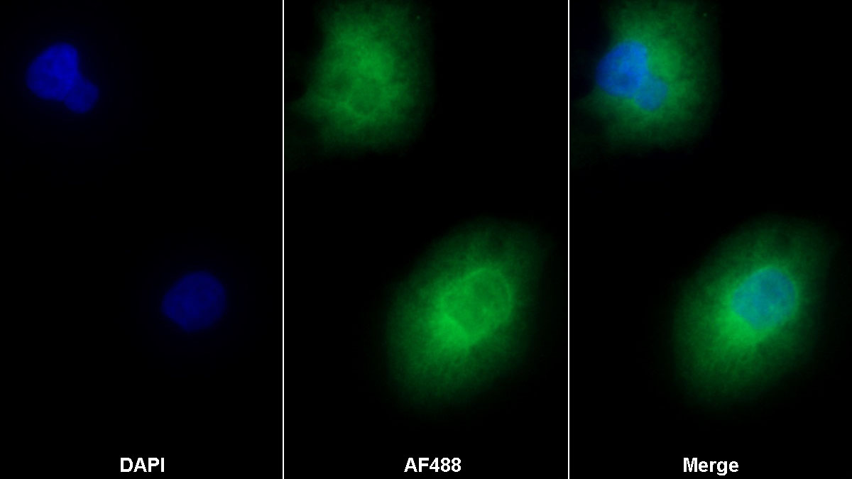 Polyclonal Antibody to Clara Cell Protein 16 (CC16)