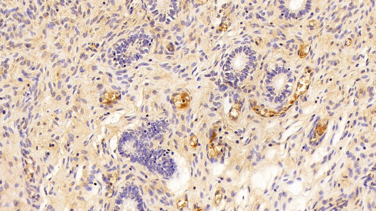 Polyclonal Antibody to Complement Component 3 (C3)