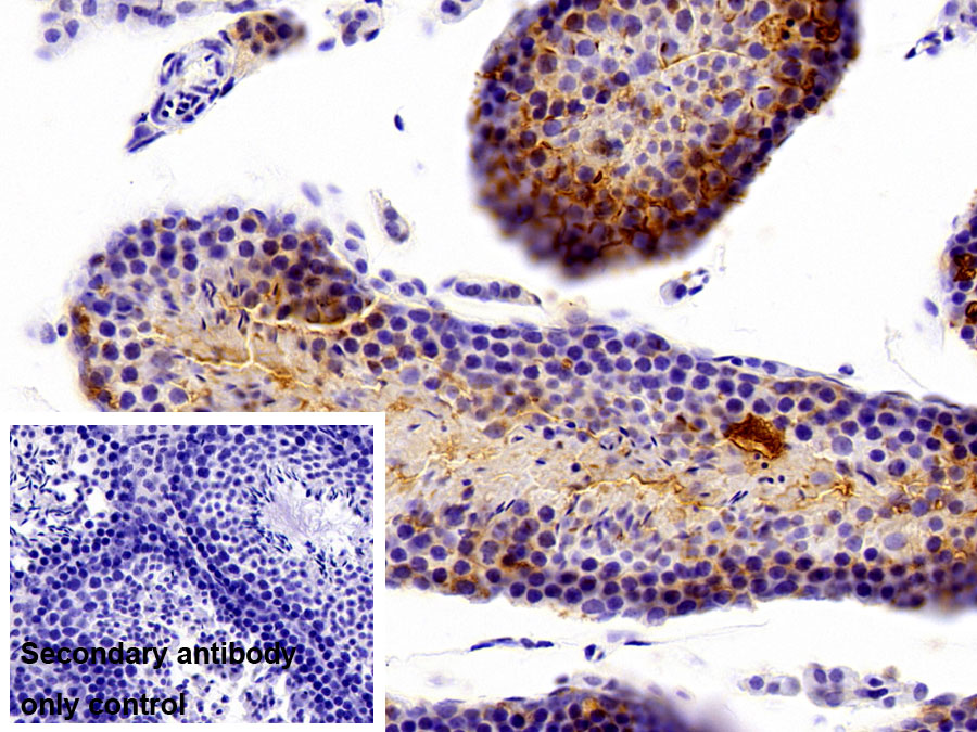 Polyclonal Antibody to Heat Shock Protein 90 (HSP90)