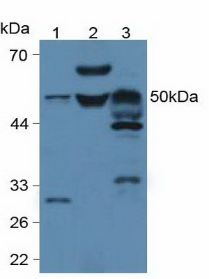 Polyclonal Antibody to Phospholipase A2 Group VII (LpPLA2)