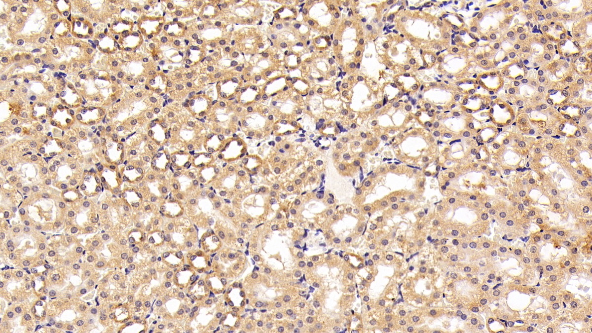 Polyclonal Antibody to Endothelial NOS (eNOS)