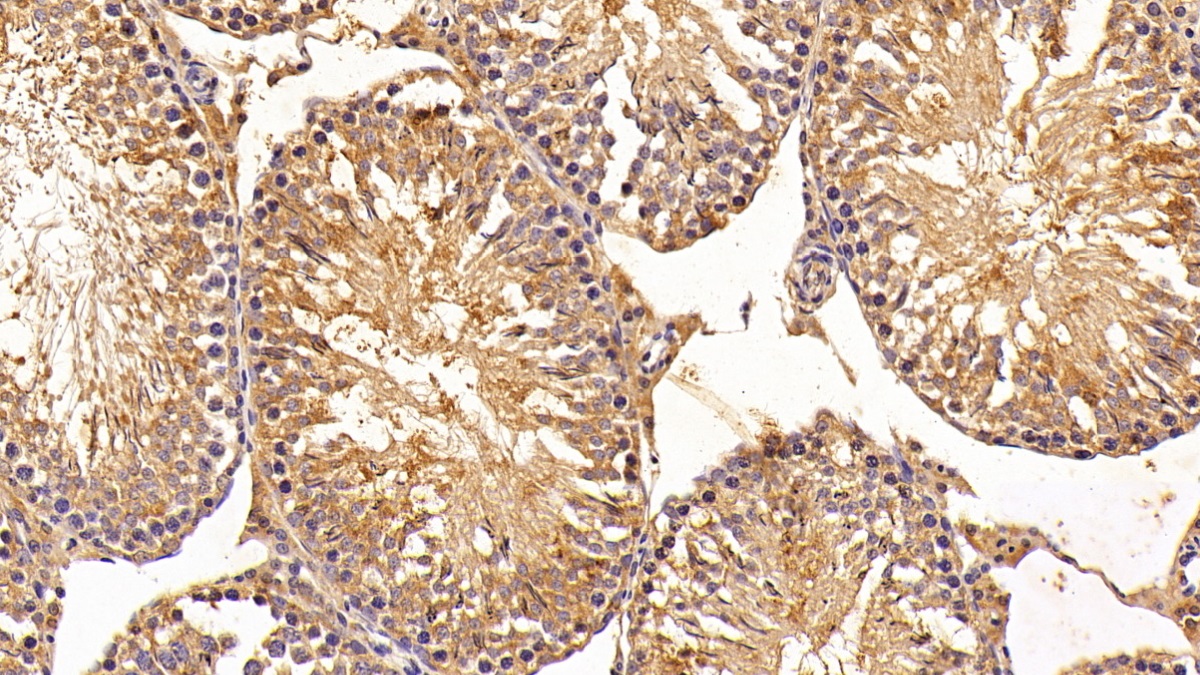 Polyclonal Antibody to Endothelial NOS (eNOS)