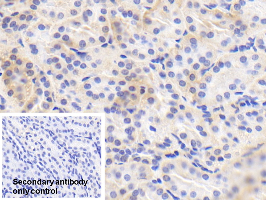 Polyclonal Antibody to Endothelial NOS (eNOS)