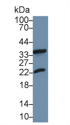 Polyclonal Antibody to Heat Shock Protein Beta 2 (HSPb2)