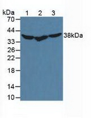 Polyclonal Antibody to Heat Shock Protein 40 (HSP40)