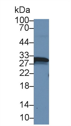 Polyclonal Antibody to Carbonic Anhydrase I (CA1)