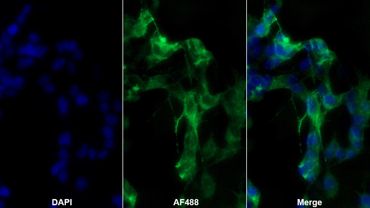 Polyclonal Antibody to Neuropeptide Y (NPY)