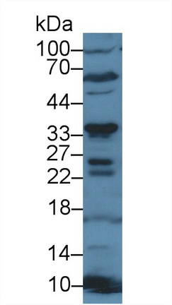 Polyclonal Antibody to Cluster Of Differentiation 200 (CD200)