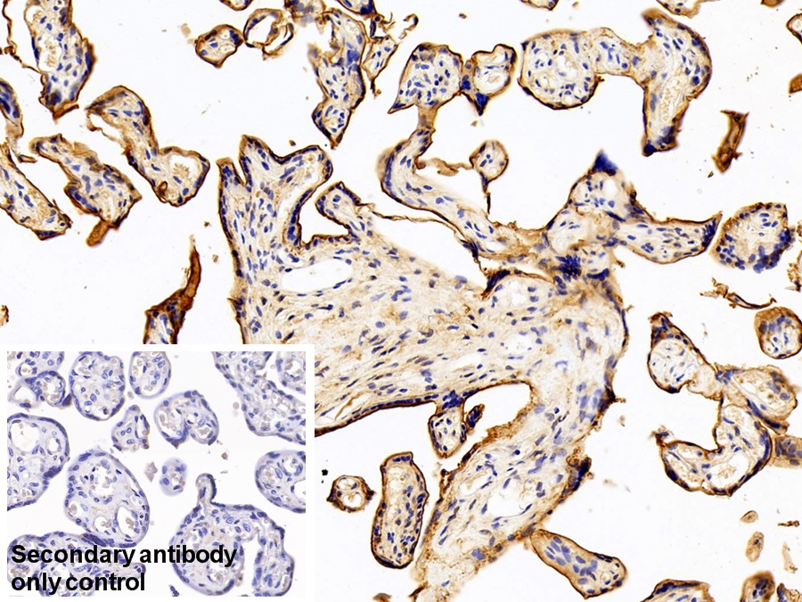 Polyclonal Antibody to Cluster Of Differentiation 200 (CD200)