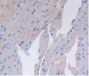 Polyclonal Antibody to Cluster Of Differentiation 26 (CD26)